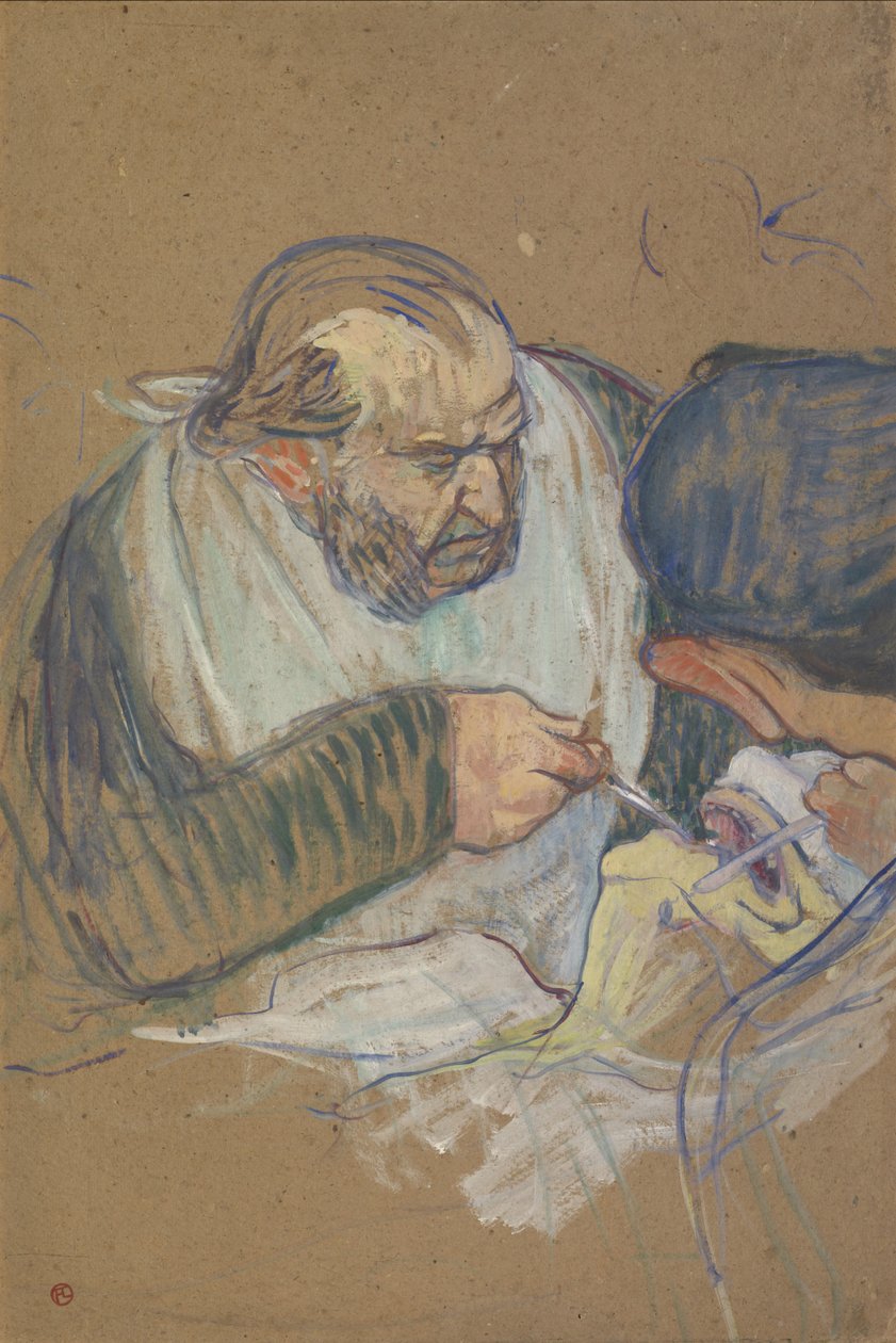 Dr. Péan Operating, 1891-92 af Henri de Toulouse Lautrec