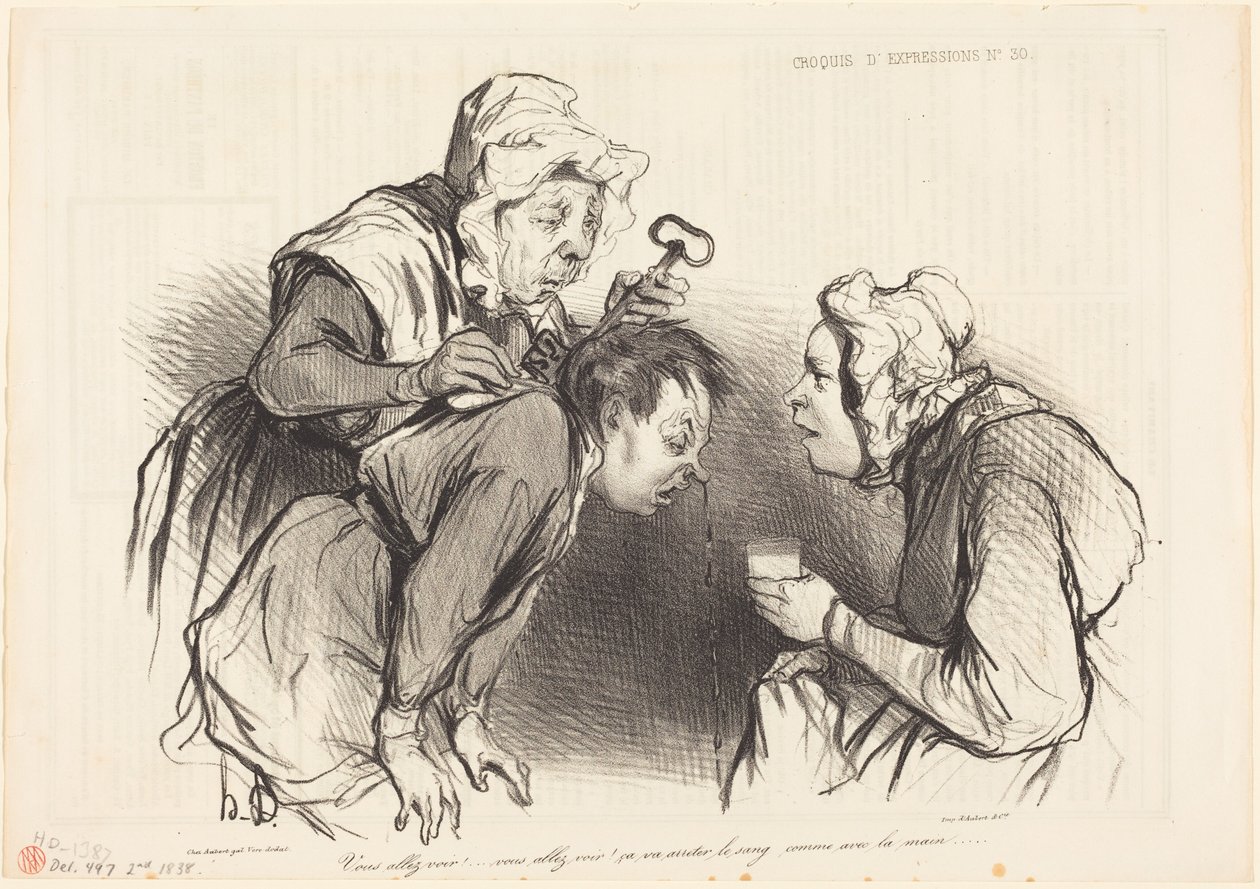 Bare vent og se!... Det vil standse blødningen... af Honoré Daumier