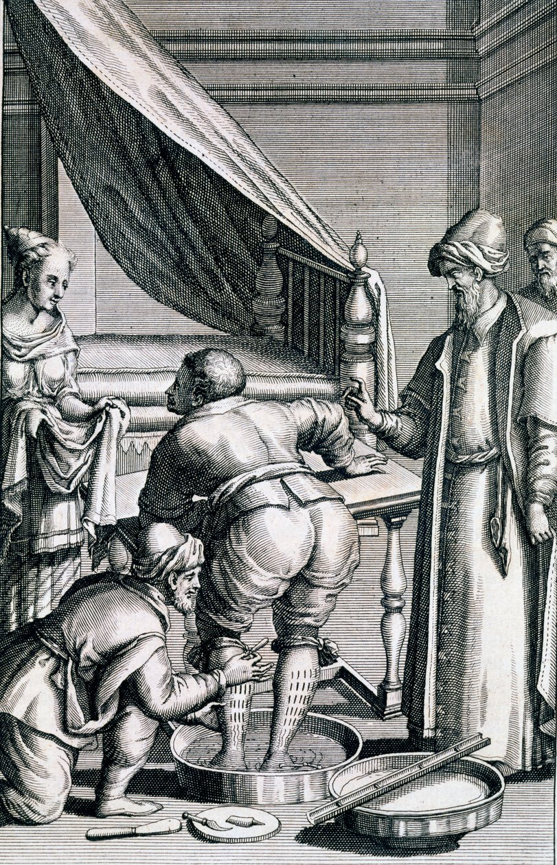 Blodladning i benene, fra Medicina Aegyptiorum af Prospero Alpini, udgivet 1745 af Italian School