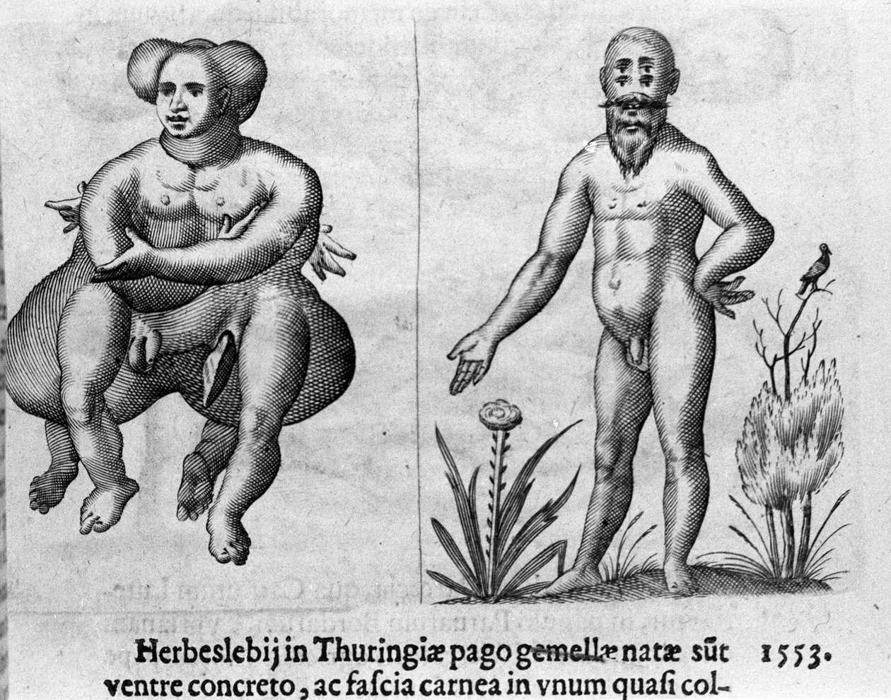 Forskellige typer menneskelige monstre. Indgravering fra "Monstrenes natur, årsager og forskelle" af Fortunio Liceti (1577-1656), italiensk videnskabsmand. 1646 af Italian School