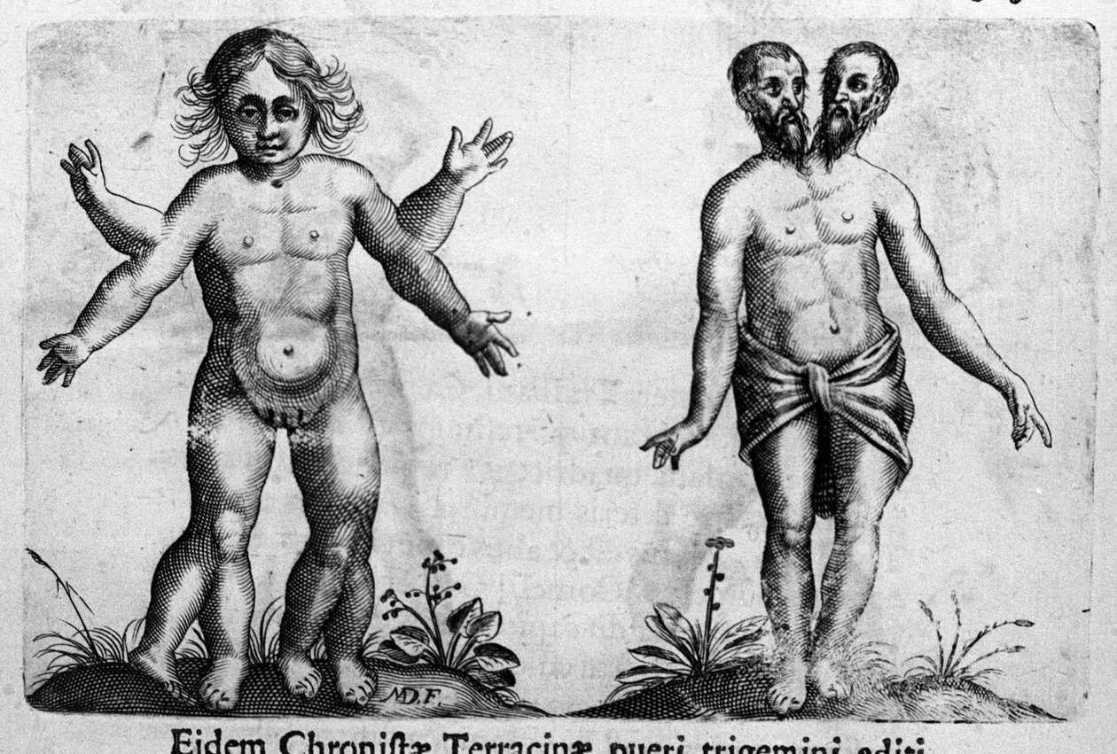 Forskellige typer menneskelige monstre Gravering fra "Monstrenes natur, deres årsager og forskelle" af Fortunio Selvomi (1577-1656), italiensk videnskabsmand. 1646 af Italian School