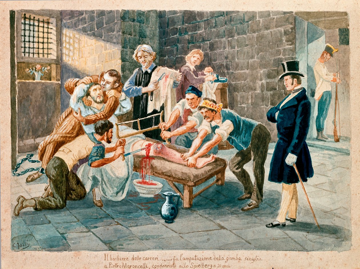 Patriot og medlem af Carboneria (Carbonarisme) Pietro Maroncelli (1795-1846) blev amputeret af sit ben under sin fængsling i bodsmanden på fæstningen Spielberg i Mähren. Tryk af det 19. århundrede Museo del Risorgimento, Milano af Italian School