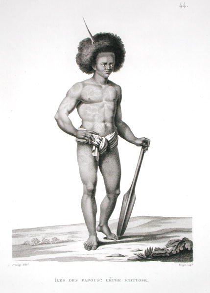Papua-øerne: Spedalskhedsoffer, fra 