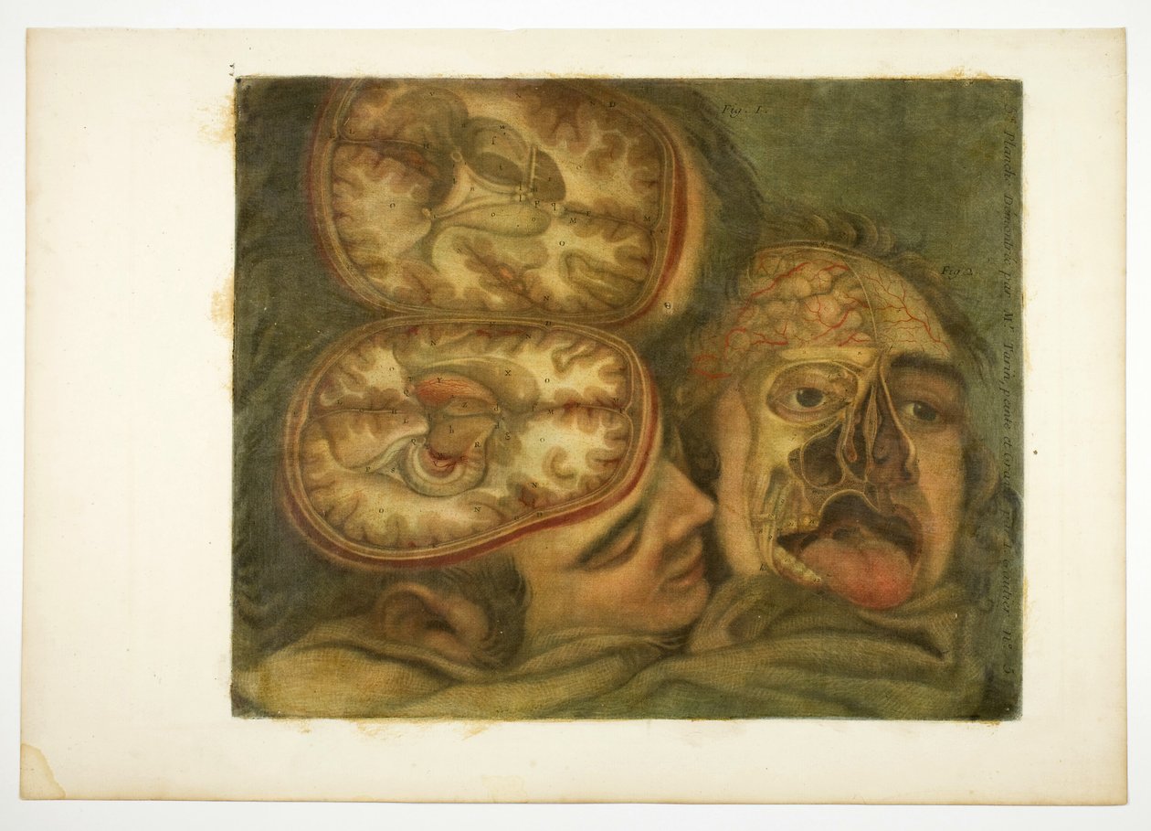 Kraniedissektion, planche fem fra Anatomy of the Head, in Printed Paintings af Jacques Fabien Gautier d