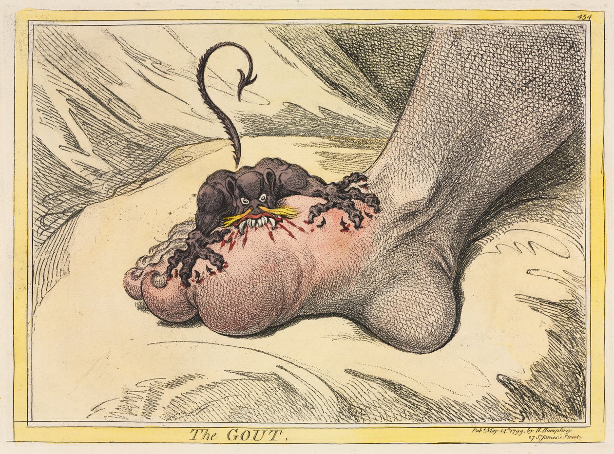 Gigten, 1799. af James Gillray