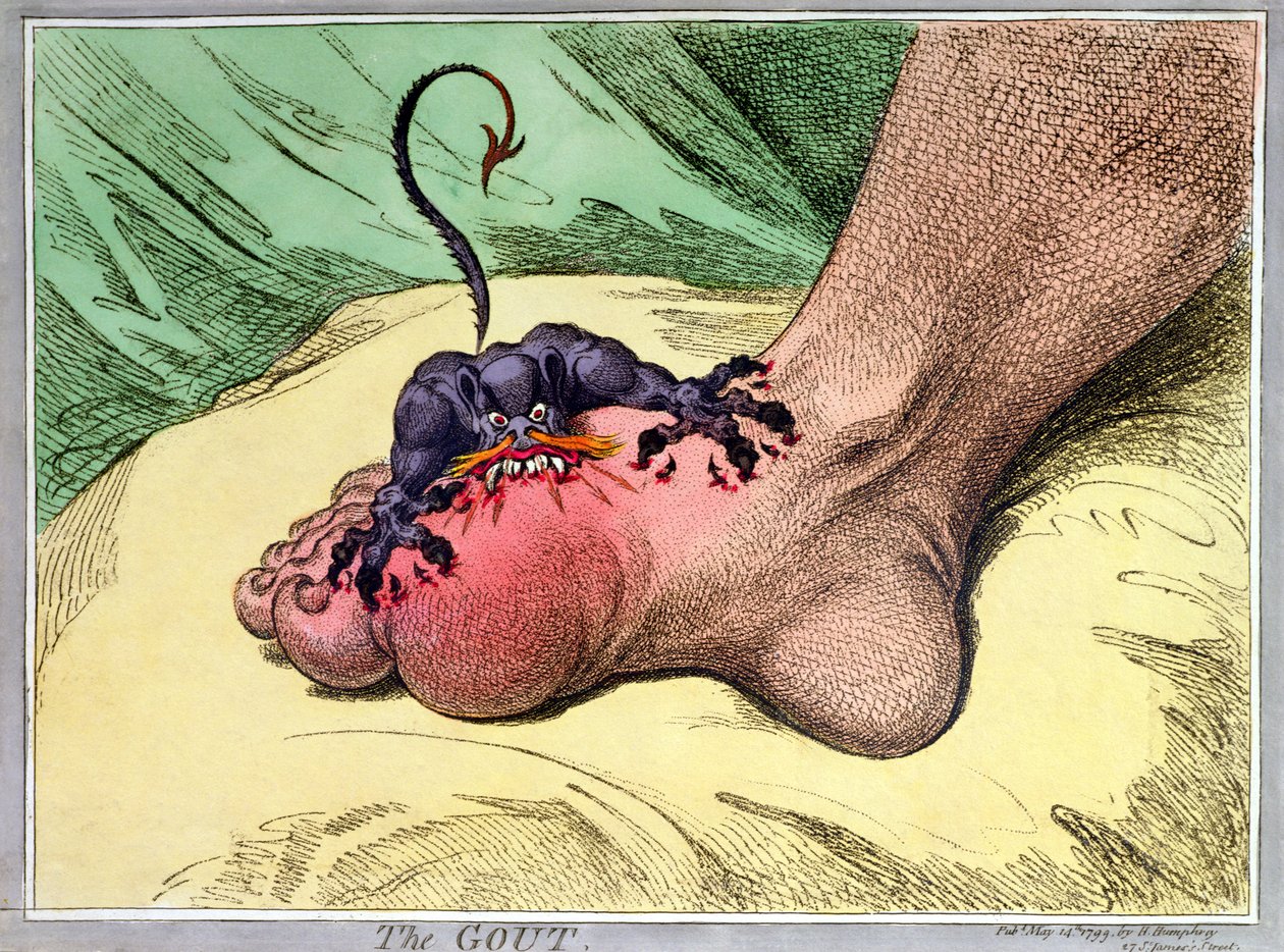 The Gout, udgivet af Hannah Humphrey i 1799 (håndfarvet softdground radering) af James Gillray