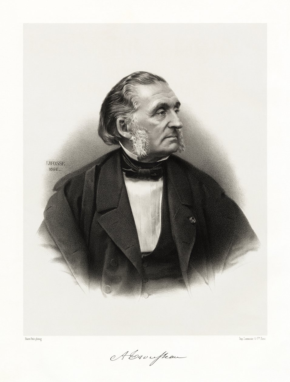 Armand Trousseau, 1865-66 af Jean Baptiste Adolphe Lafosse