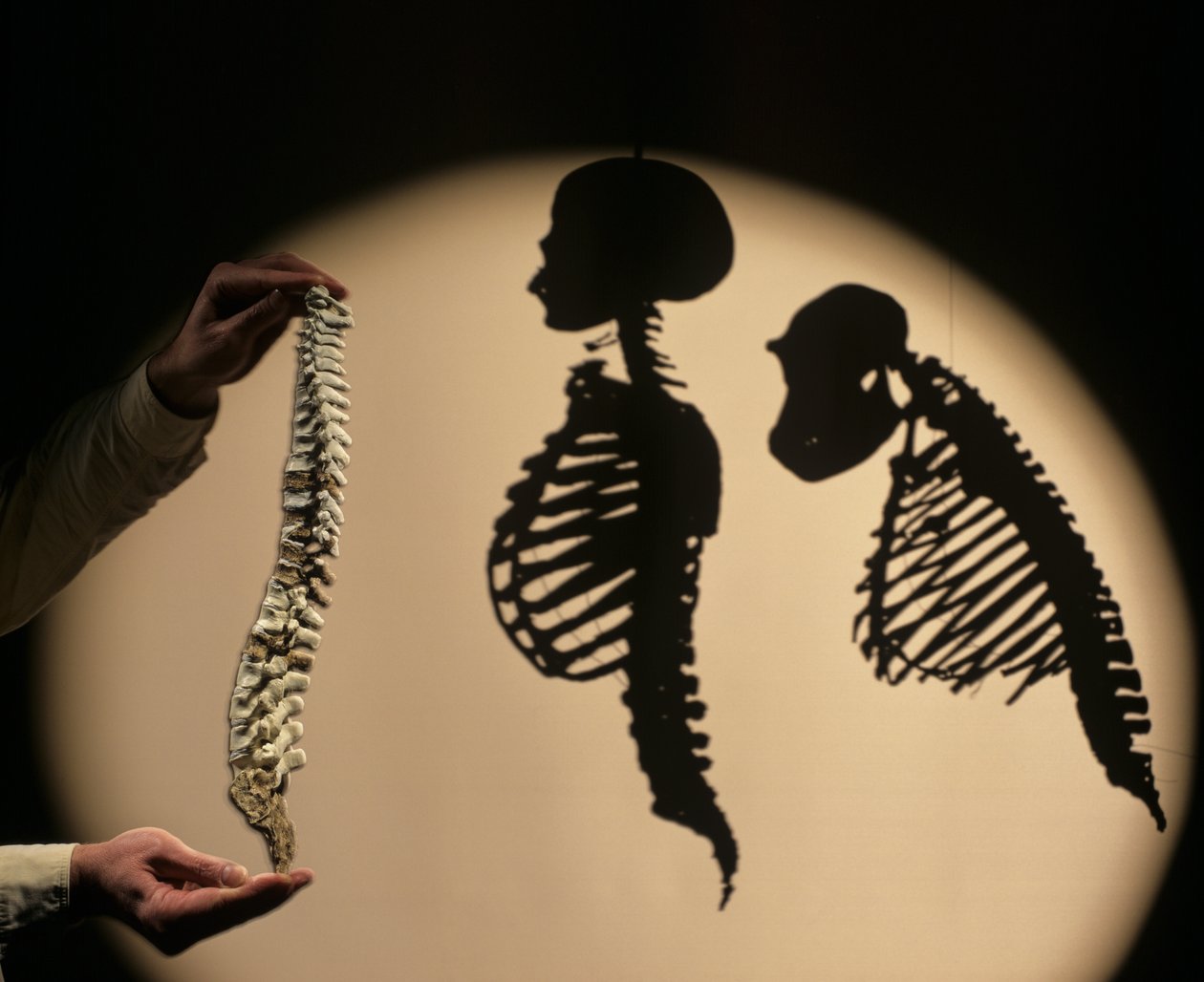 DOH, De første skridt, rygmarvsrekonstruktion, Bruce Latimer, Cleveland Museum of Natura... af Kenneth Garrett