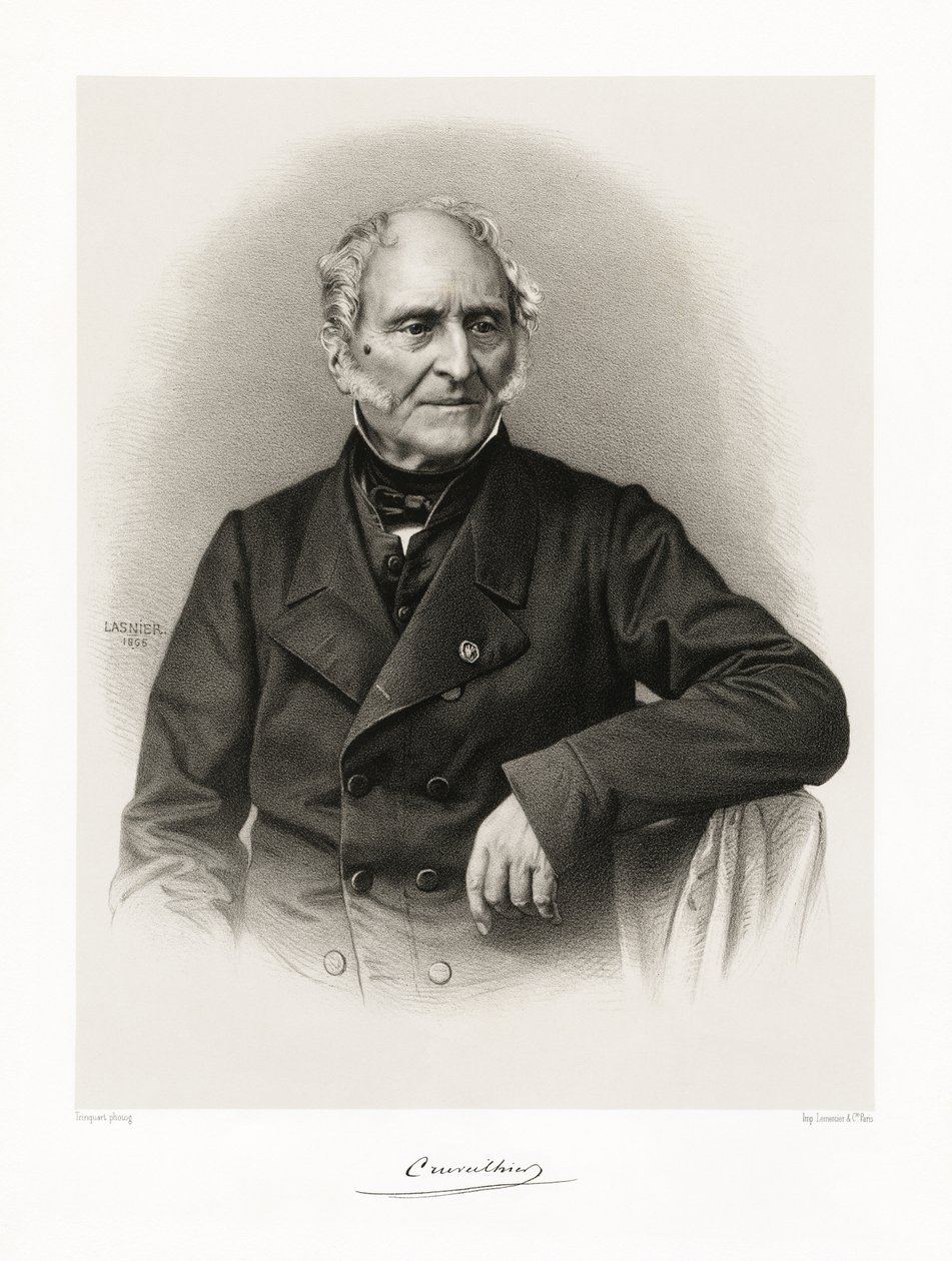 Jean Cruveilhier, 1865-66 af Lasnier