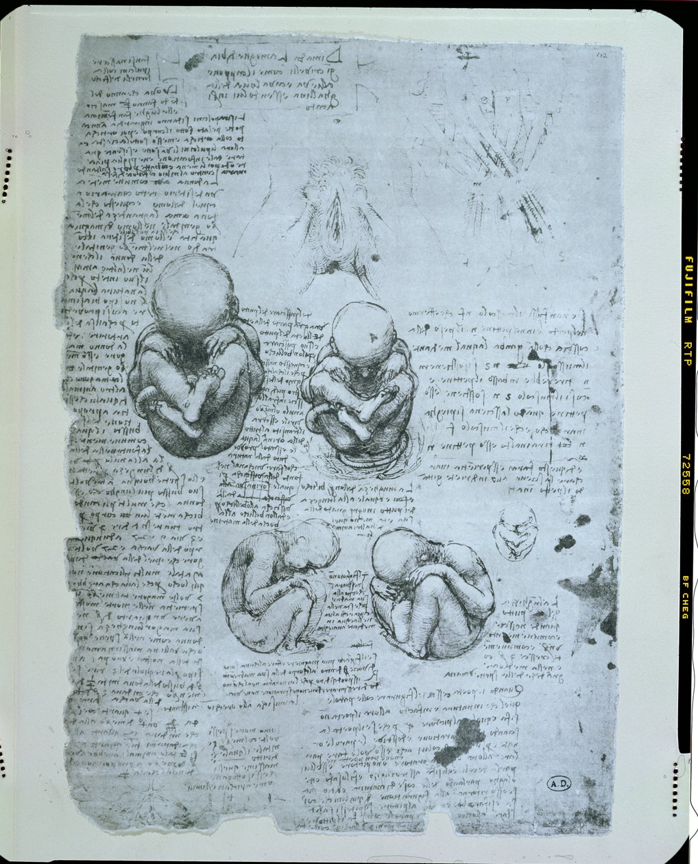 Fem visninger af et foster i livmoderen, faksimilekopi af Leonardo da Vinci