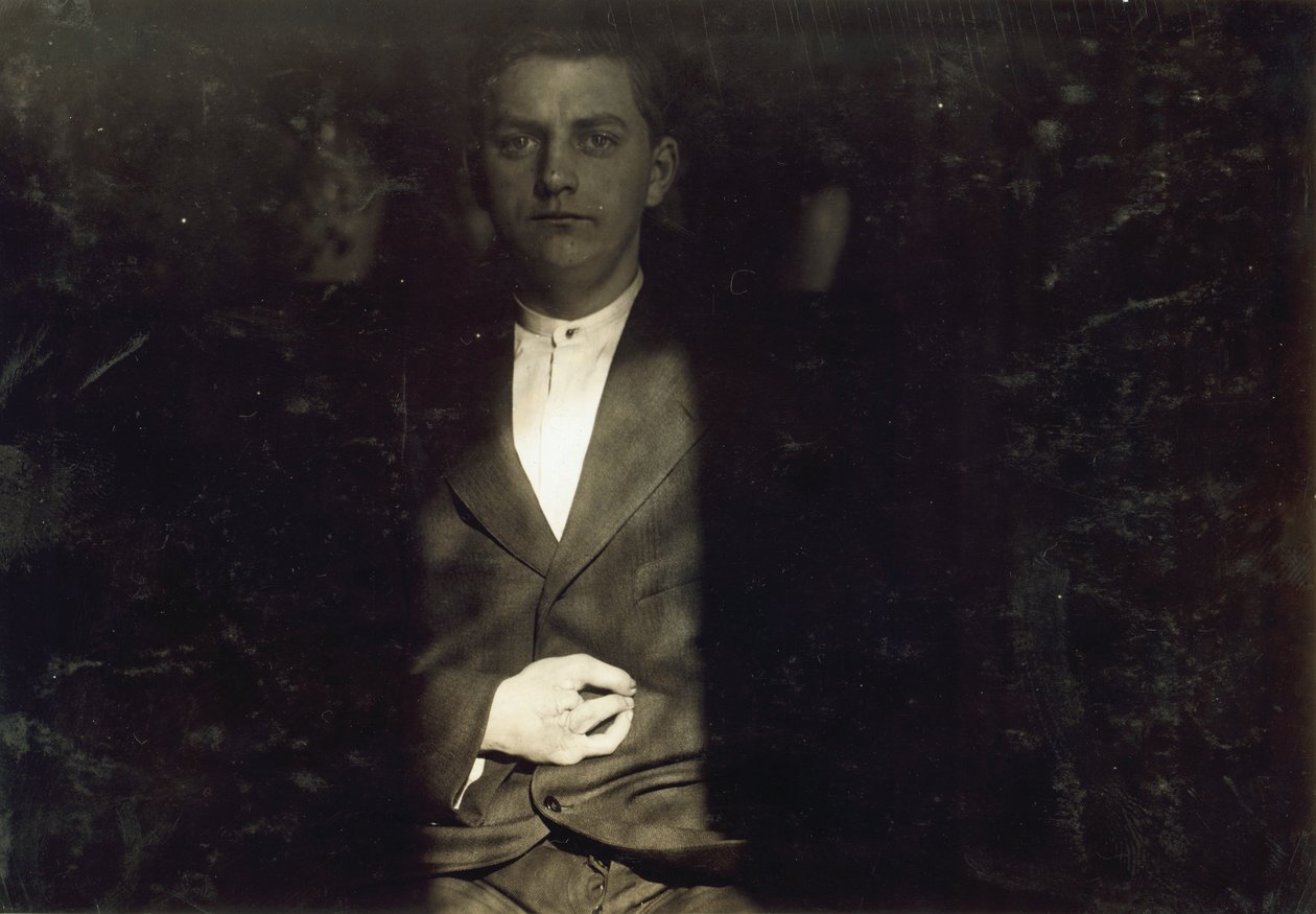 Frank Wiegel fra Brooklyn, skadet efter at have arbejdet 18 timer om dagen som 15-årig, to fingre blev amputeret af hans højre hånd, New York City af Lewis Wickes Hine