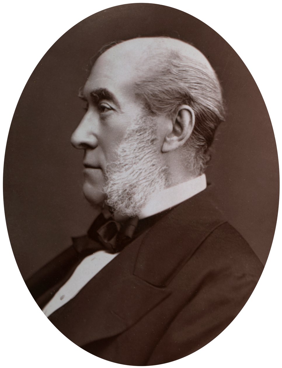 Sir William Fergusson, Bart, FRS, sergent-kirurg hos dronningen, 1877. af Lock and Whitfield