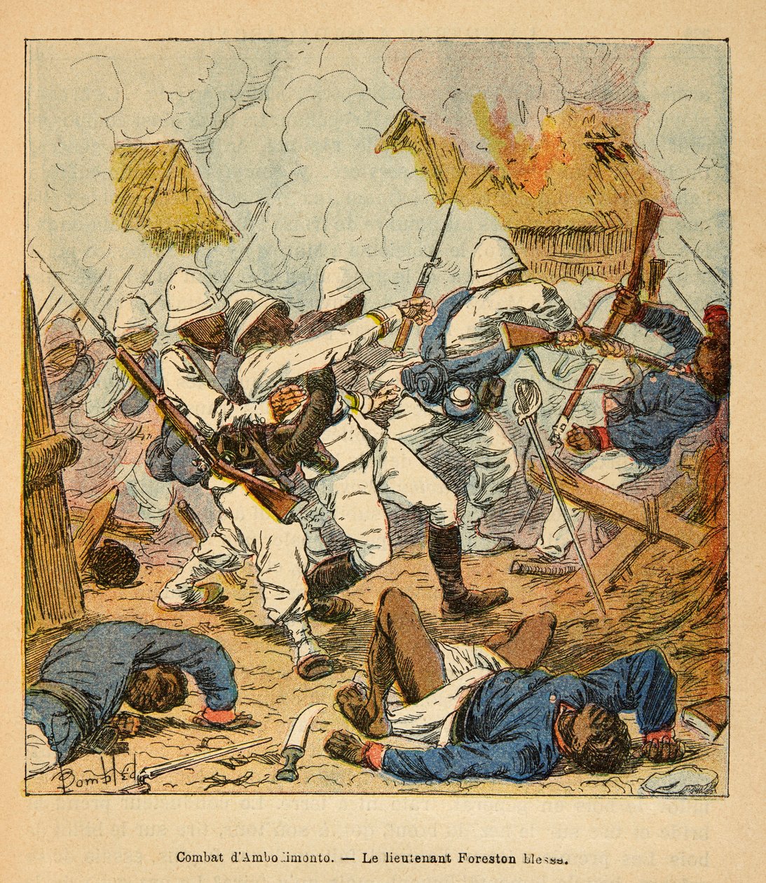 The War in Madagascar-Anekdotisk historie om de franske ekspeditioner i 1885-1895 af Henri Galli dit Galllichet (1854-1922), illustreret af Louis Bombled (1862-1927): Løjtnant Foreston sår under kampene ved Ambolomonty i 1895, privat samling af Louis Charles Bombled