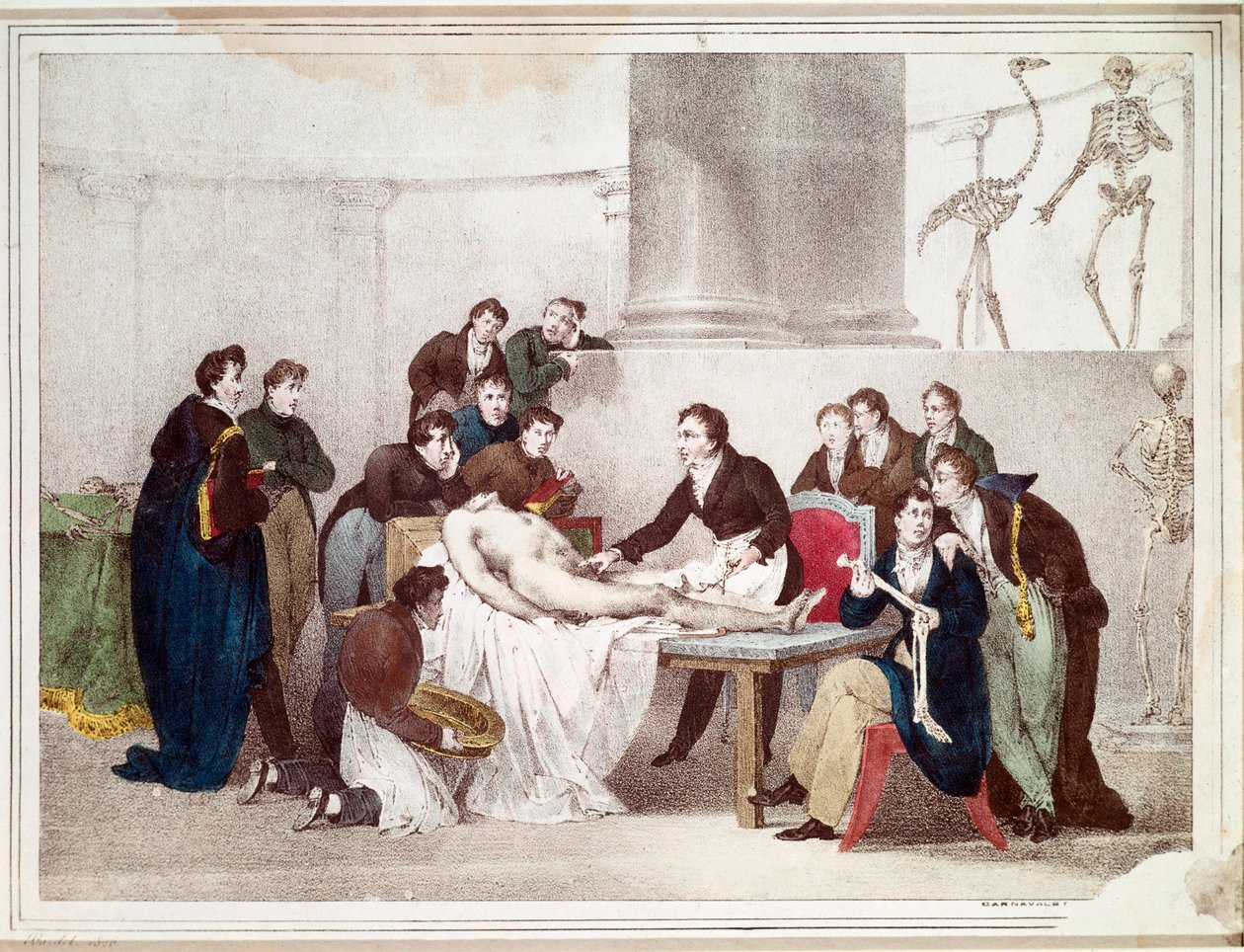 Anatomi lektionen (litografi af Louis Thomas Bardel