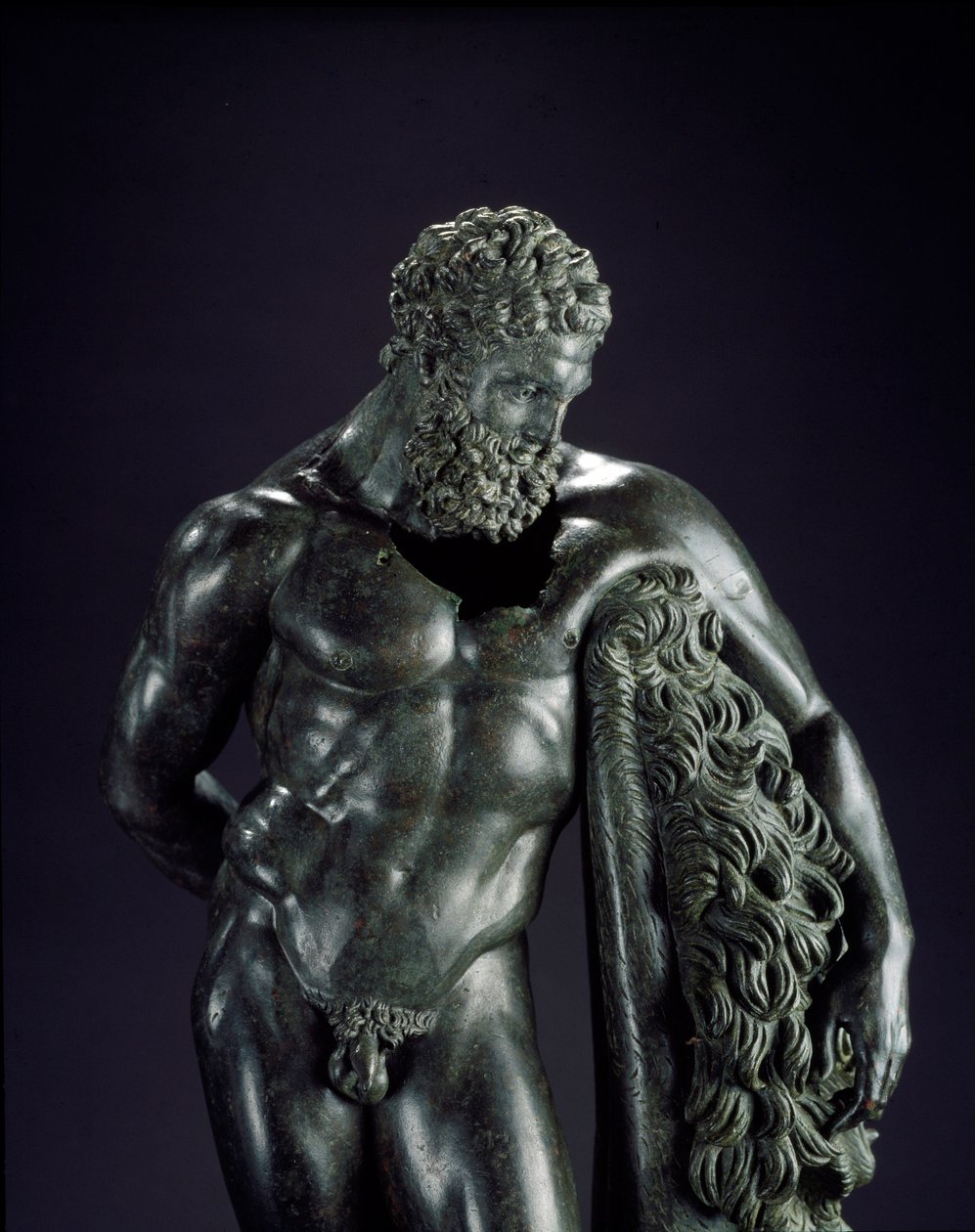 Græsk kunst: ""Herakles i hvile"" Detalje. Bronzeskulptur af Lysippe af Sicyone (395-305 f.Kr.) 4. århundrede f.Kr. Fra Ercole Curinos helligdom, Sulmona. Museo Nazionale Archeologico, Chieti Italien - Herakles (Hercules) hviler - Detalje af bronzeskulptur af Lysippos (attributed to)