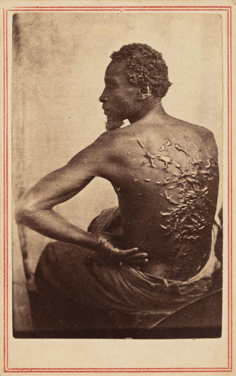 Den piskede ryg, ca. 1863 (foto) af McPherson & Oliver