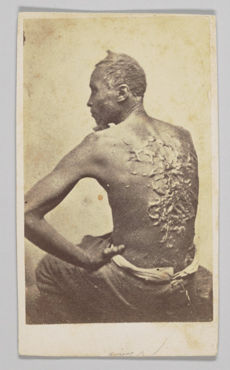 Gordon under medicinsk inspektion, 1863. af McPherson and Oliver