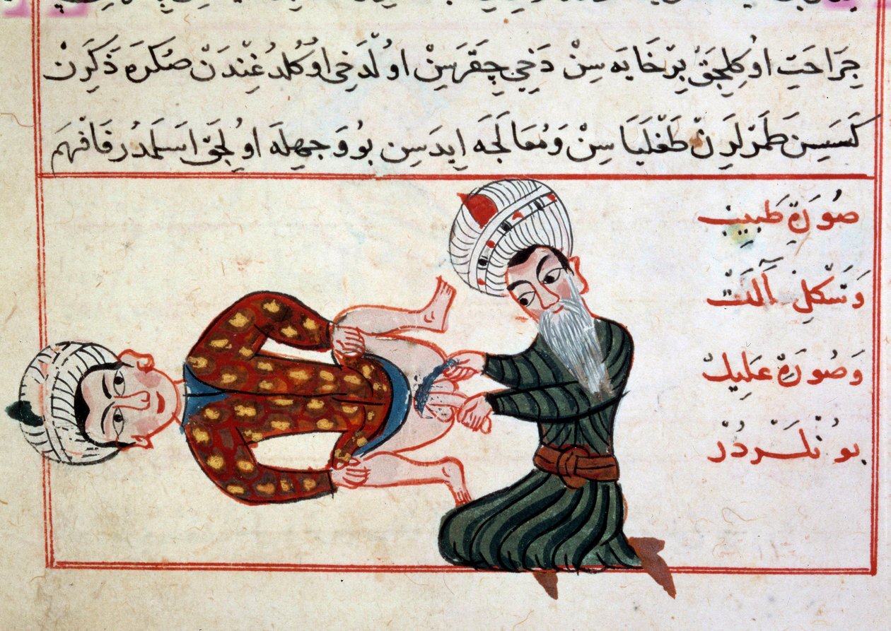 Medicin: emaskulering af en hermaphoditis. Miniature fra en behandling af tyrkisk medicin af Sharaf al-din af Ottoman School
