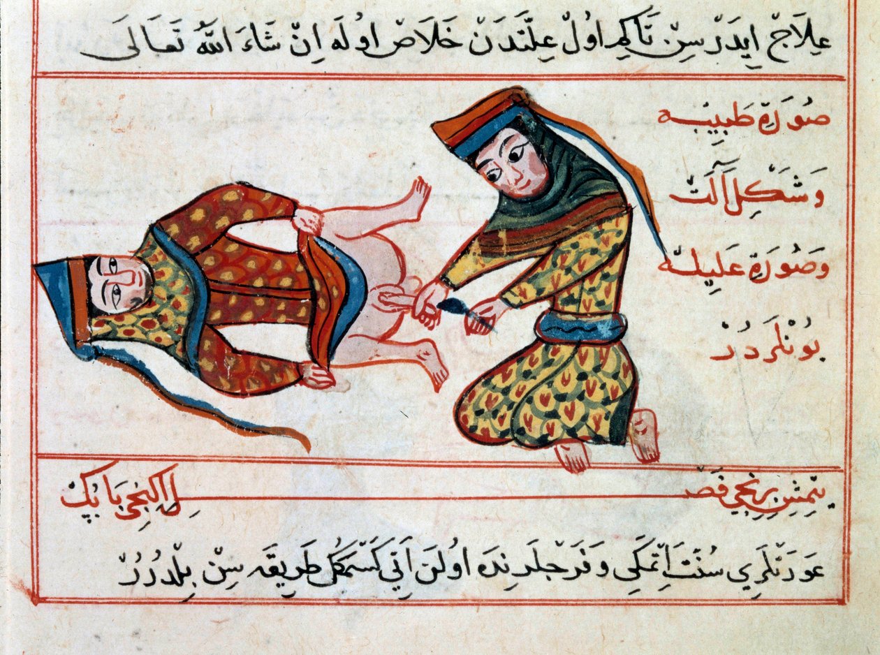 Medicin: operation af en hermaphoditis. Miniature fra en behandling af tyrkisk medicin af Sharaf al-din af Ottoman School