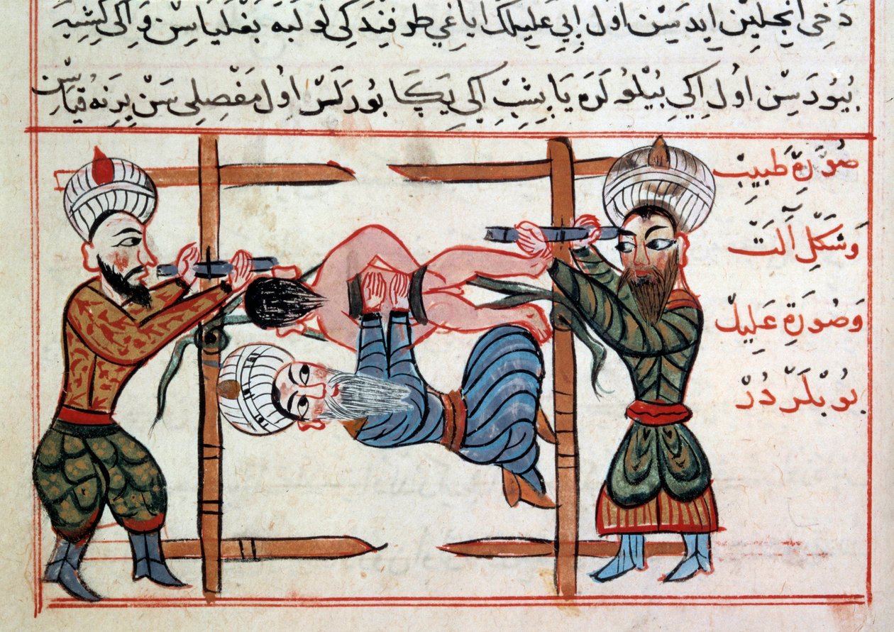 Reduktion af et brud. Miniature fra en behandling af tyrkisk medicin af Sharaf al-din af Ottoman School