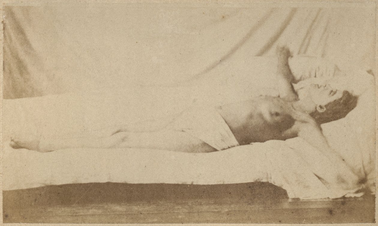 Hysterisk epilepsi, anfald, korsfæstelse, plade VI fra "Iconographie Photographique de La Salpetriere" af Bourneville et P. Regnard, Paris, 1876 (albumenprint) af Paul Regnard