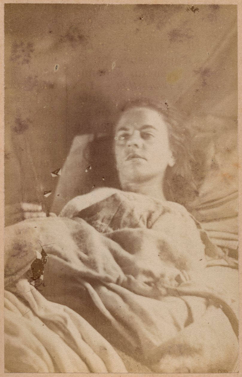 Hysterisk epilepsi, anfald, tredje periode, plade XXVI fra "Iconographie Photographique de La Salpetriere" af Bourneville et P. Regnard, Paris, 1876 (albumenprint) af Paul Regnard