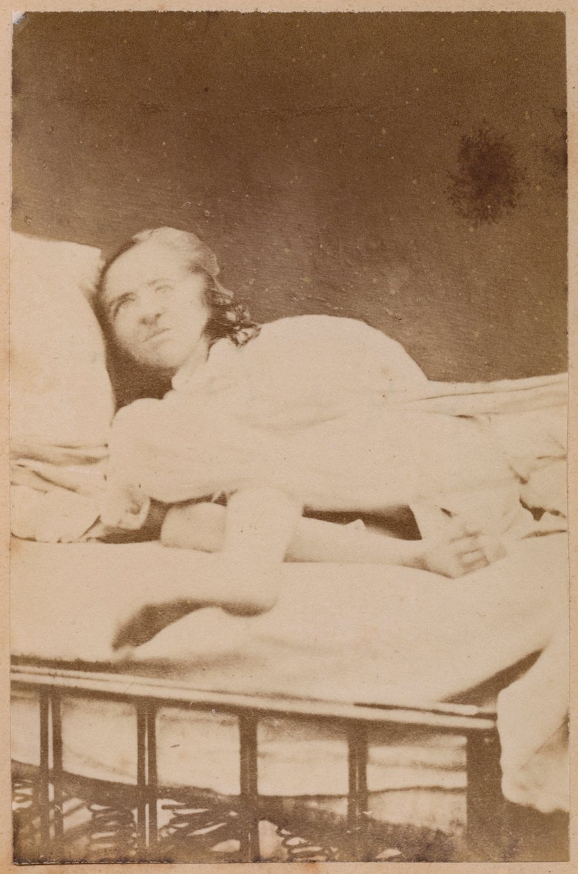 Hysterisk epilepsi, forvridninger, plade XXXVIII fra 