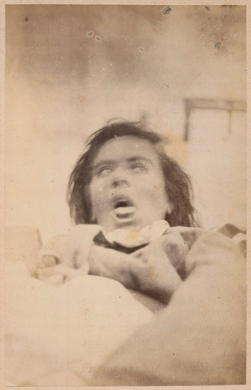 Hysterisk epilepsi, hallucinationer, kvaler, plade XXIX fra 