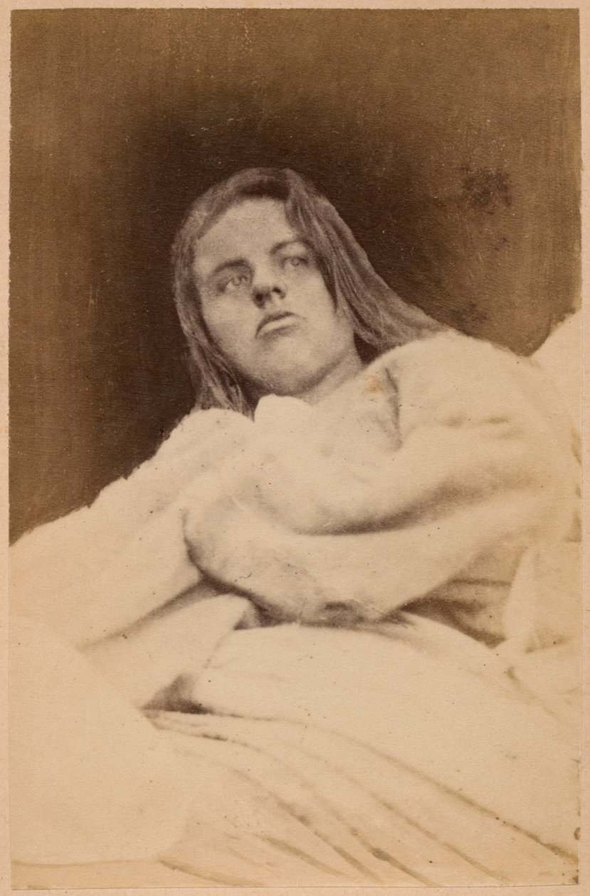 Hysterisk epilepsi, hallucinationer, foragt, plade XXXI fra "Iconographie Photographique de La Salpetriere" af Bourneville et P. Regnard, Paris, 1876 (albumenprint) af Paul Regnard