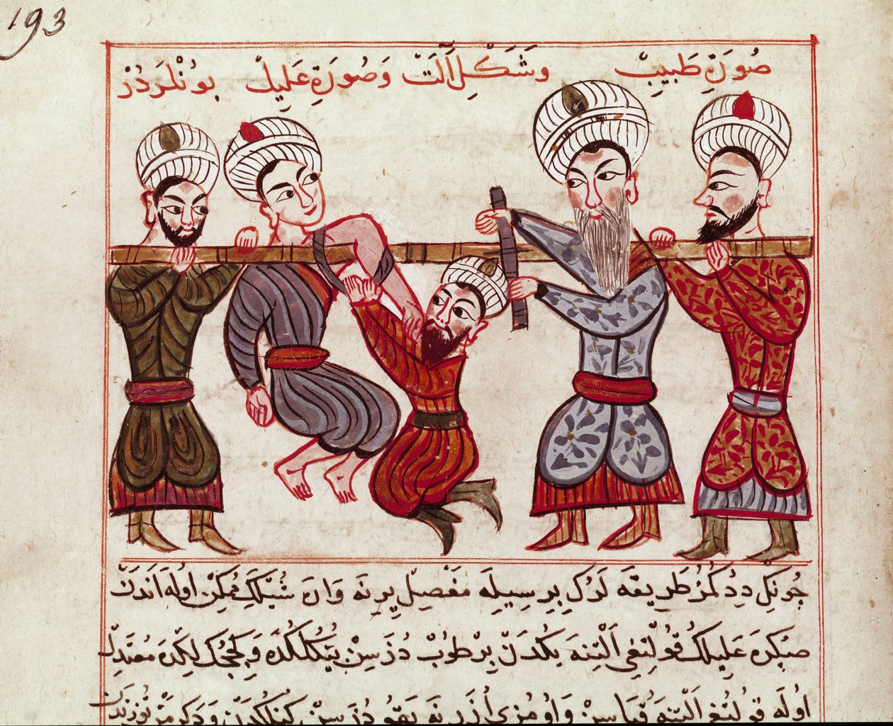 Medicin: ortopædisk intervention. Miniature taget fra en malkning af tyrkisk medicin af Charaf-ed-din (Charaf ed Din) (1404-1468) efter "" La Surgery Imperiale"" (Ms Sup Turk 693 fol. 193) 1466 Paris, B.N. af Persian School
