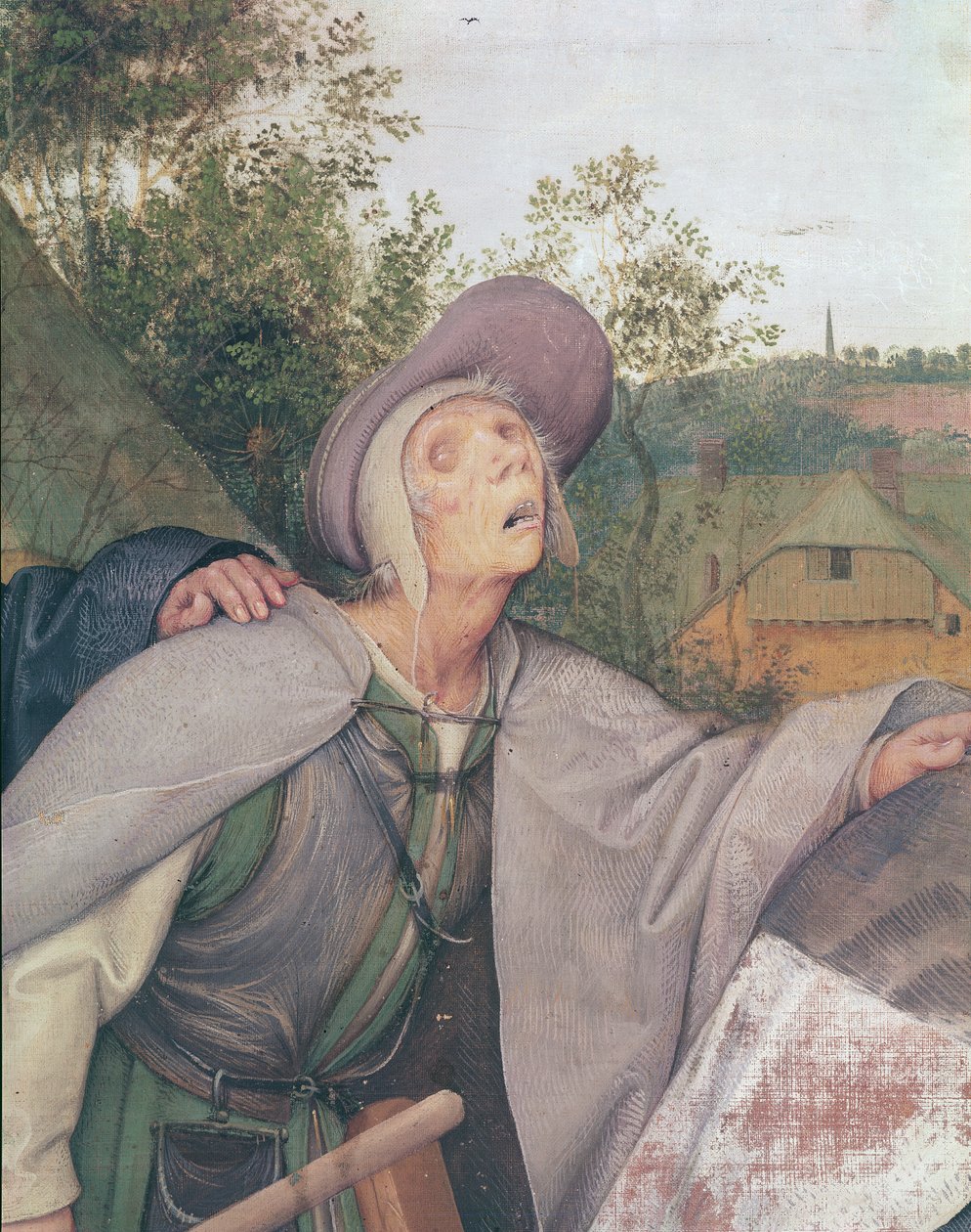 Lignelsen om de blinde, detalje af en blind mand, 1568 olie på lærred detalje af 29163 af Pieter Bruegel the Elder