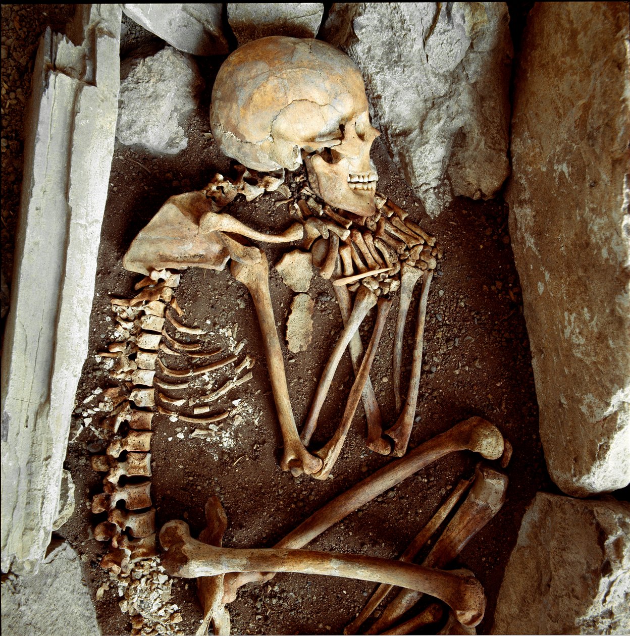 Forhistorie: Kvindelig skelet fra hulen i Candide Arene (Finale Ligure). Stenalder, neolitisk. Gener, Museo di Archeologia Ligure af Prehistoric Prehistoric