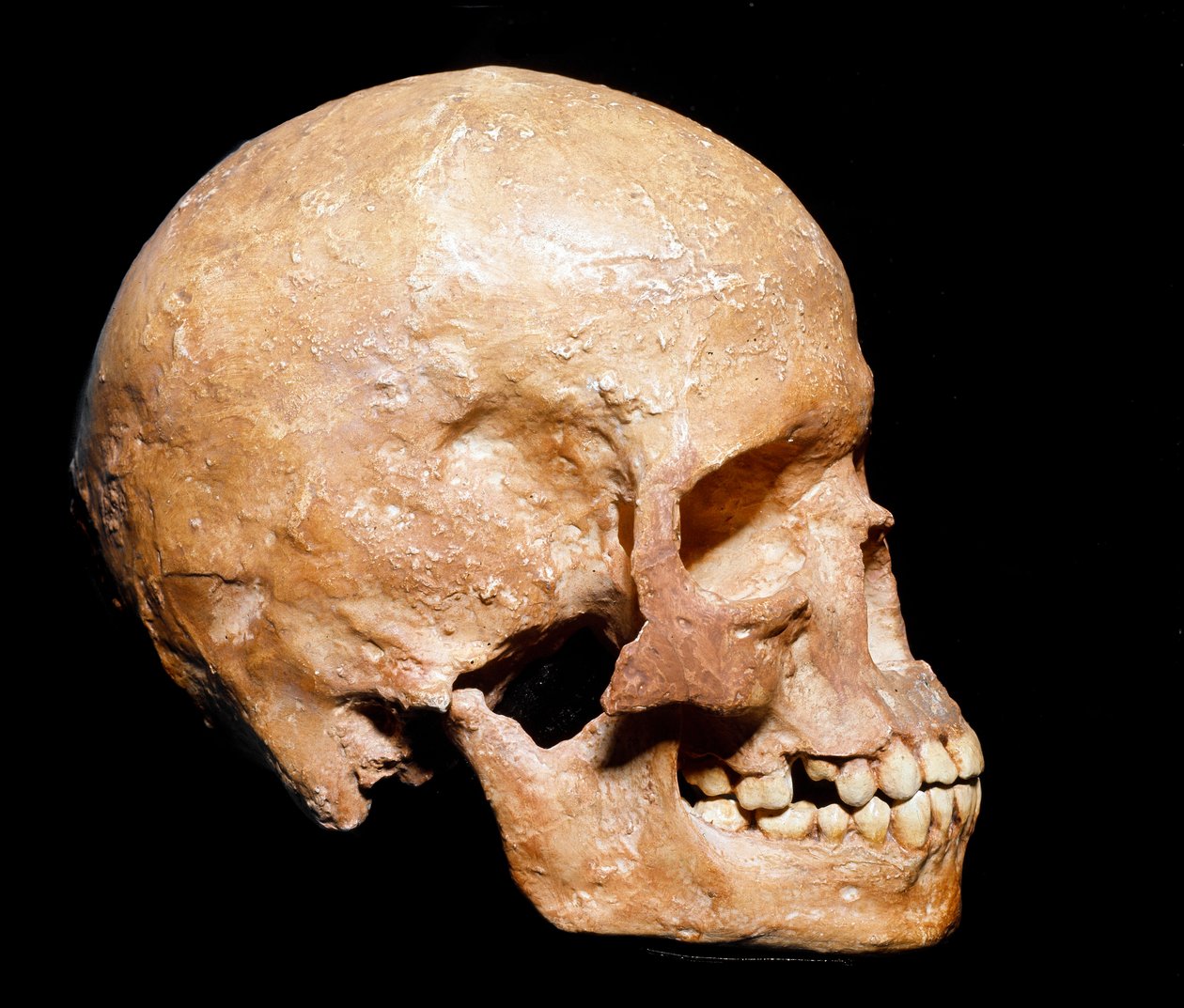 Forhistorie: fossilt kranie af Homo sapiens fra Grimaldi. Kultur af Aurignacian, Øvre Paleolithic. Museo Civico di Storia Naturale, Milano - Forhistorie: fossilt Homo sapiens-kranie fra Grimaldi, Ventimiglia (Italien). Aurignacian kultur, øvre palæolitikum af Prehistoric Prehistoric