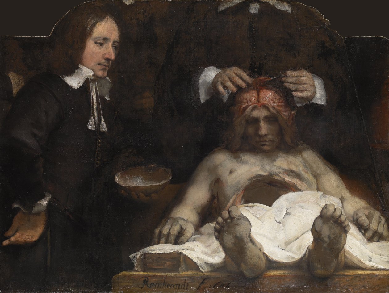 The Anatomy Lesson of Dr. Jan Deyman, 1656dani af Rembrandt van Rijn