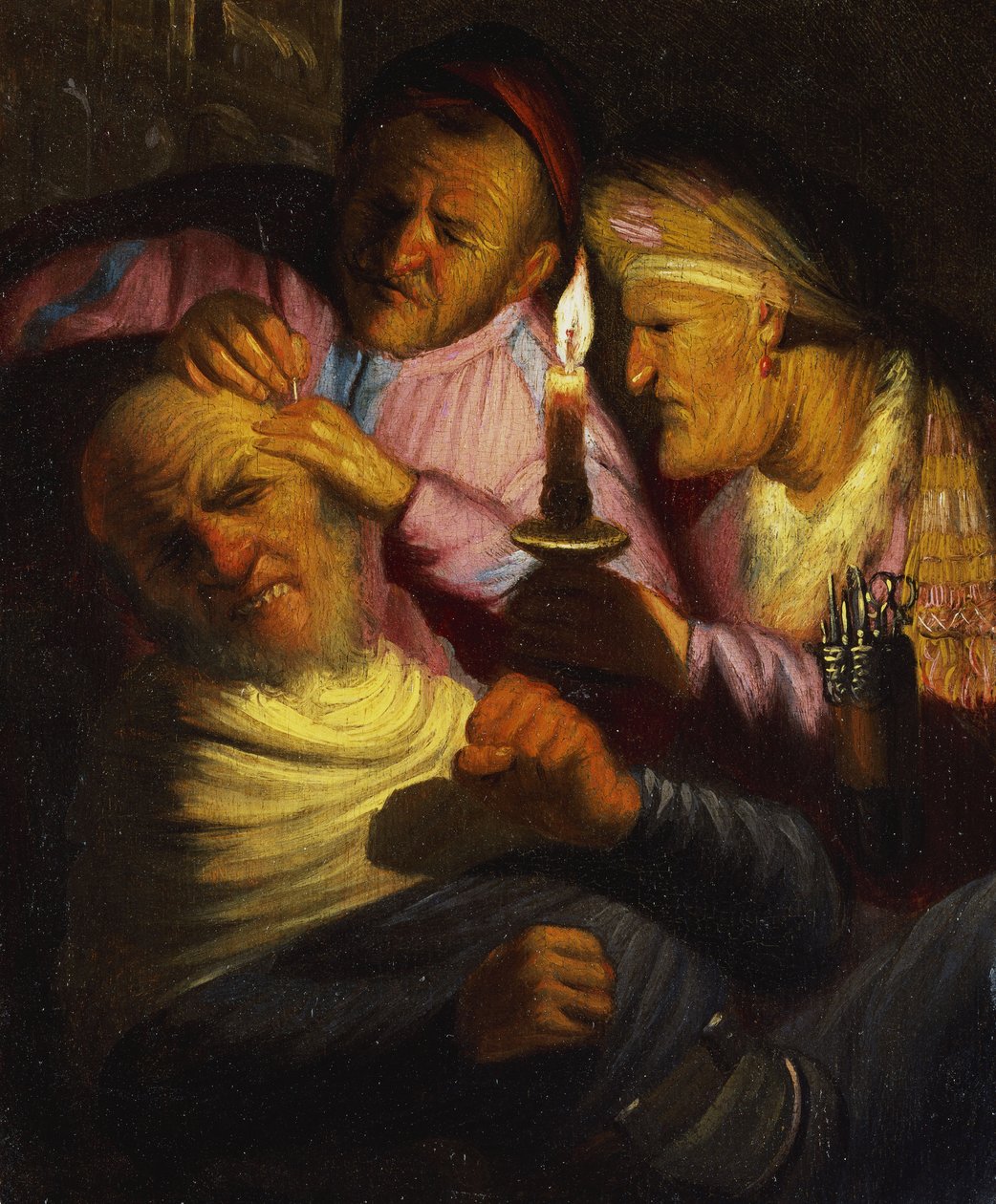 The Sense of Touch: The Stone Operation af Rembrandt van Rijn