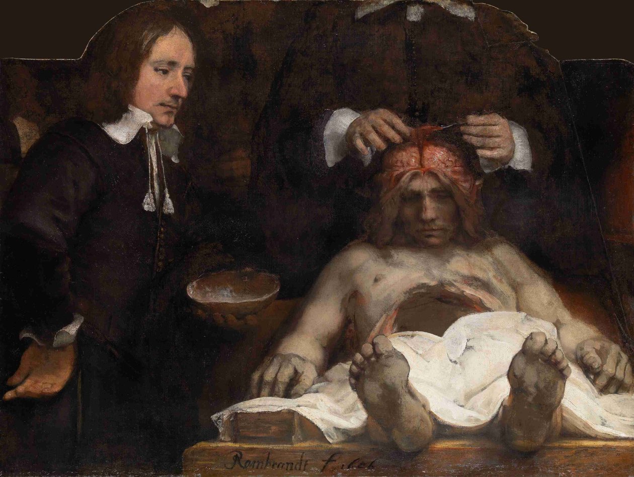 Dr. Jan Deijmans anatomi-lektion, 1656 af Rembrandt van Rijn