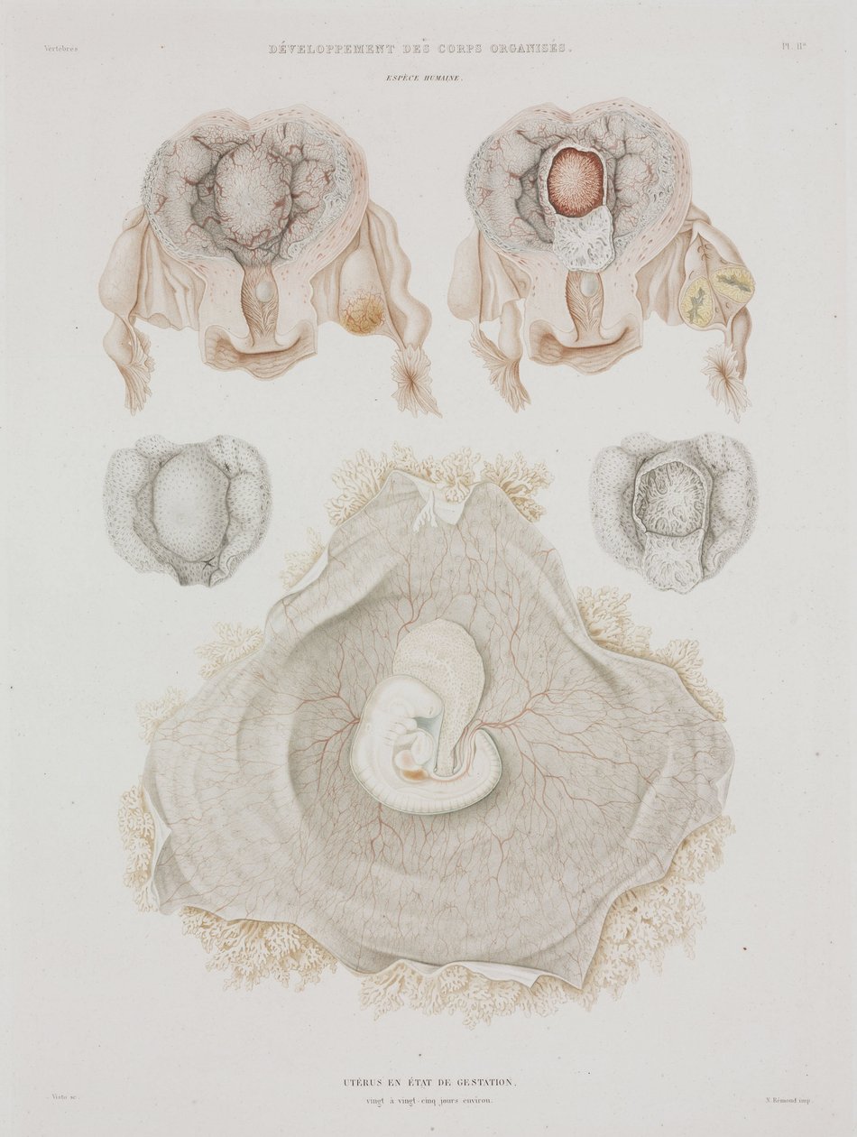 Gynækologi Menneskelig livmoder med embryo, c 1847-1859 af John Pardon