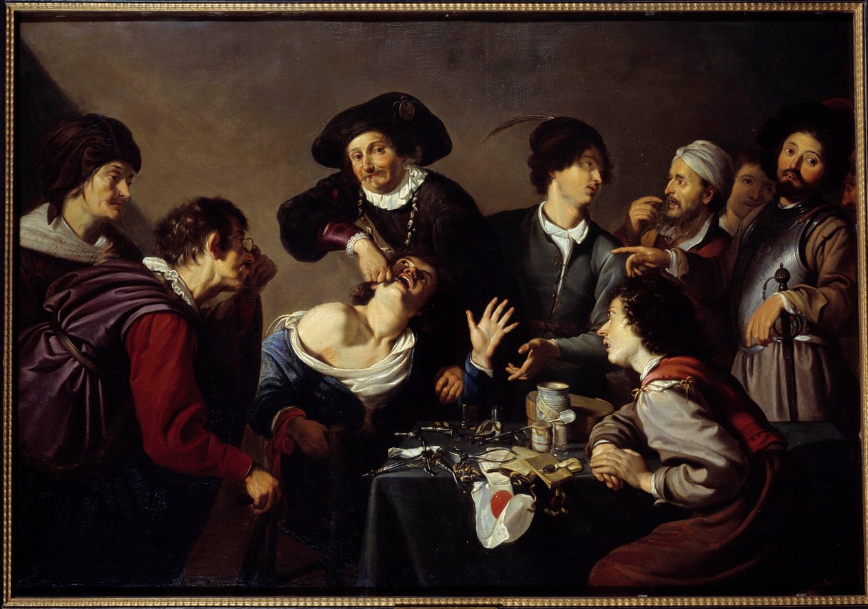 The Teeth Remover A dentist surrounds his assistants and instruments tears a patient "s tooth. Painting by Theodore Romboutsdani af Theodor Rombouts