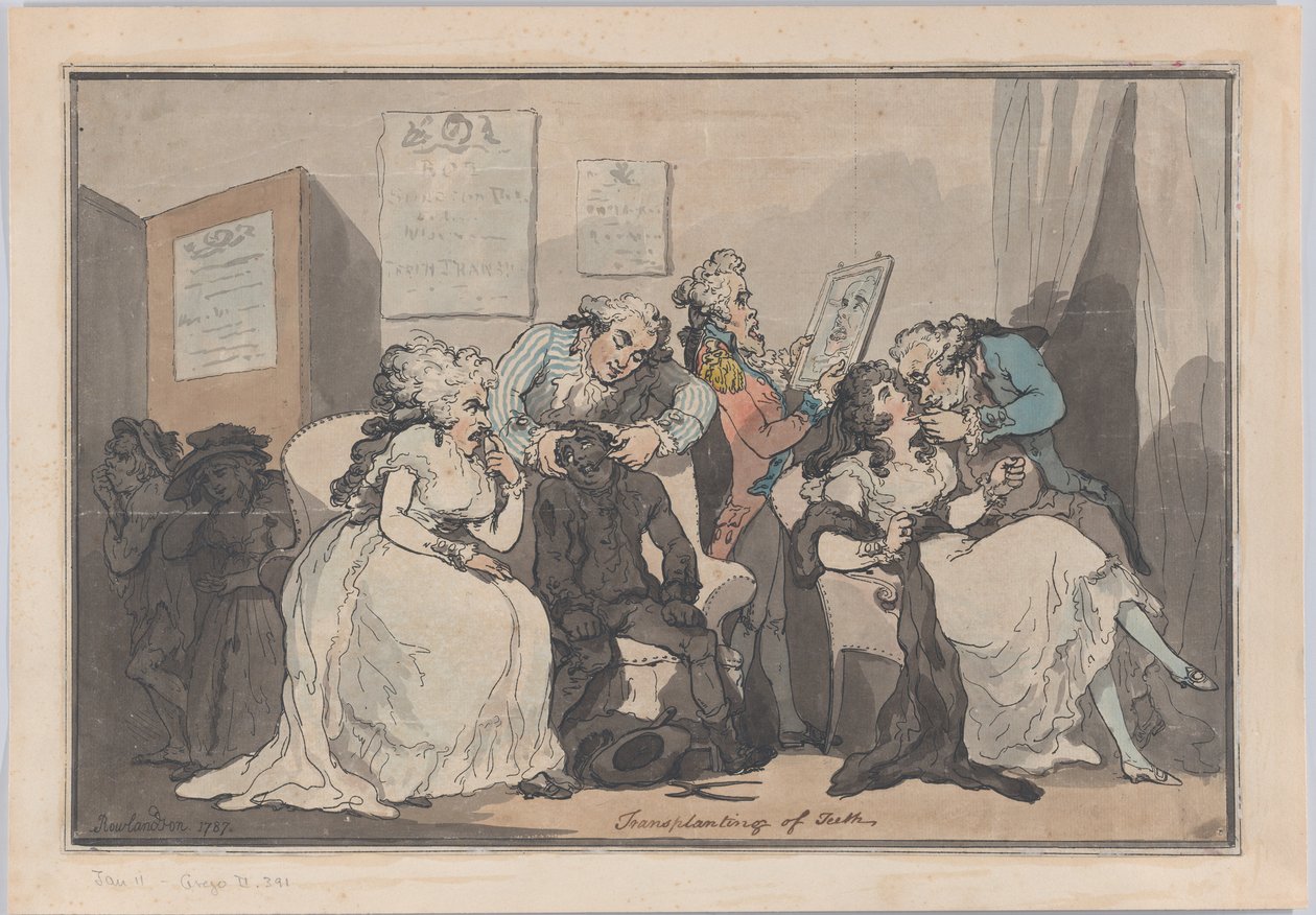 Transplantation of Teeth, 1787., 1787. af Thomas Rowlandson