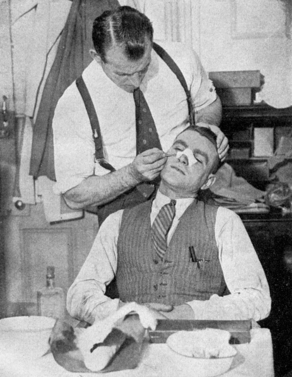 Englands kaptajn Eddie Hapgood modtager behandling for en brækket næse efter en kamp med Italien, 1934. af Topical Press Agency