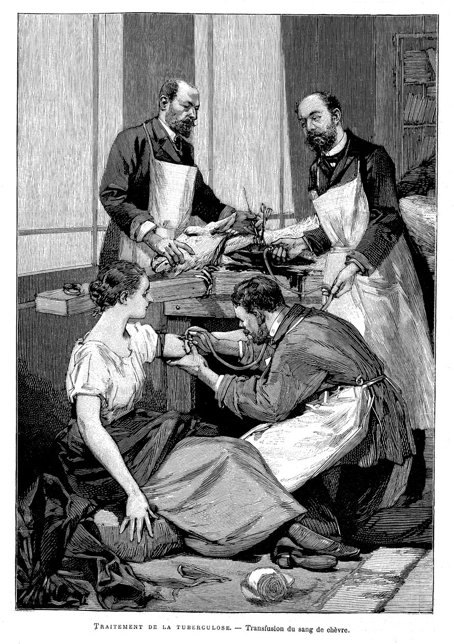 En tuberkulosepatient får en transfusion af gedeblod, 1891 af Unbekannt