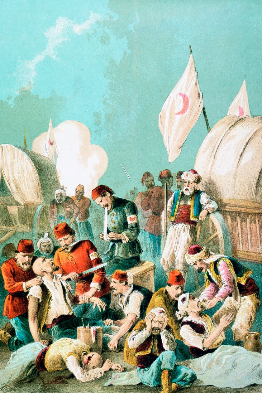 Arm bliver amputeret uden bedøvelse, Russisk-tyrkisk krig, 1877 af Unbekannt