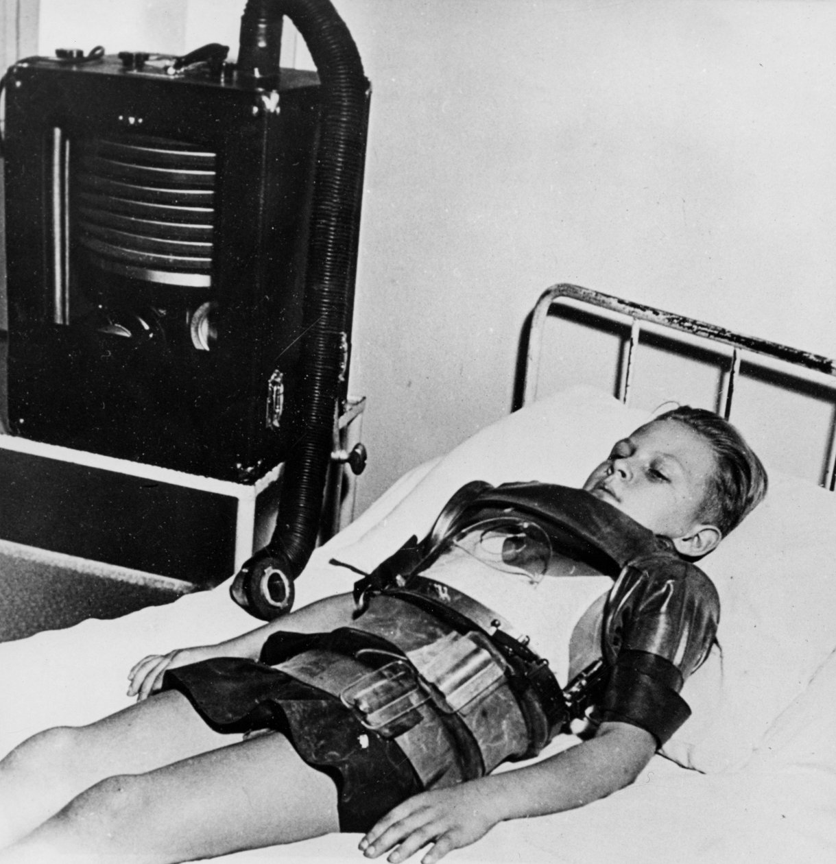 Elleve år gammel dreng i en jernlunge, Beaujon Hospital, Paris, c1947-1951 af Unbekannt