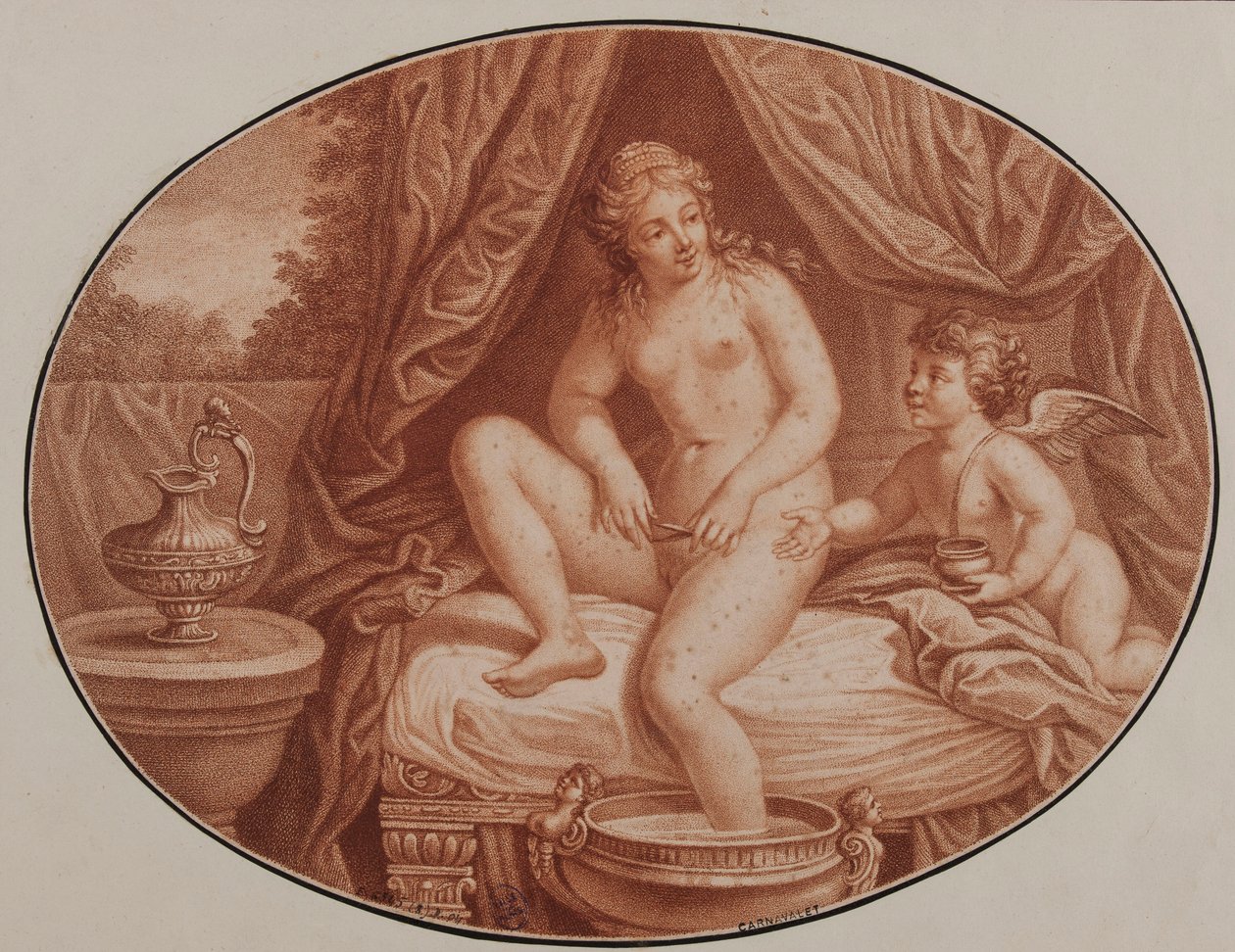 Epilering, 1700-tallet. af Unbekannt