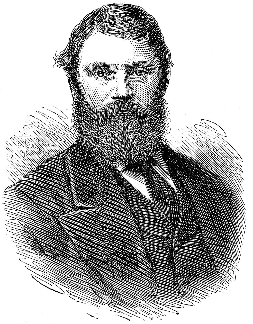 Francis Edmund Anstie 1833-1874, engelsk læge, 1874 af Unbekannt