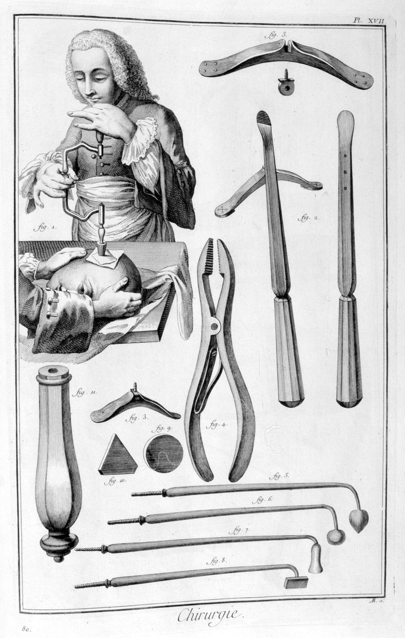 Hovedkirurgi, 1751-1777 af Unbekannt