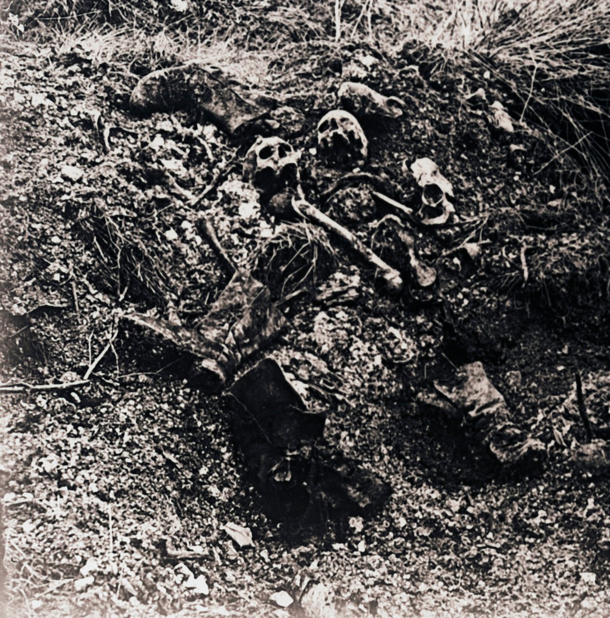 Menneskelige rester, c1914-c1918 af Unbekannt