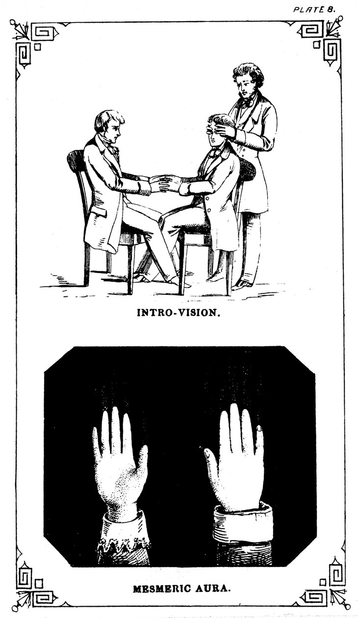 Hypnose: introvisionskraft ved at se ind i en krop, 1889 af Unbekannt