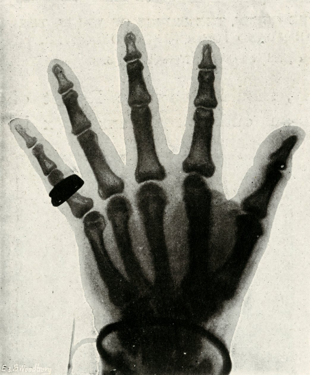 Røntgenbillede af hånden af H.R.H. Prinsen af Wales, c1897 af Unbekannt