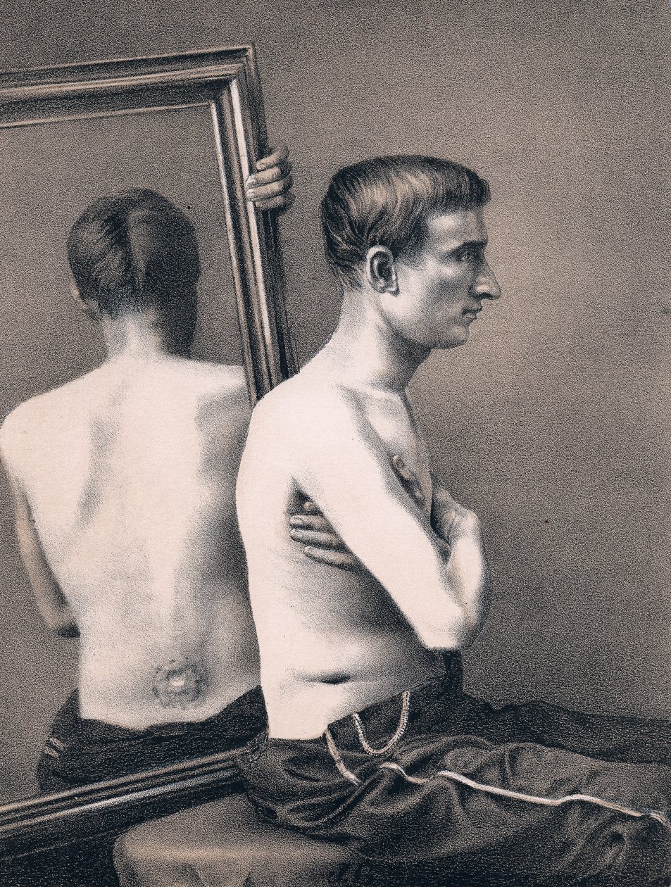 Genfinder ofre af et skudsår i maven, Amerikansk borgerkrig, 1865 af Unbekannt